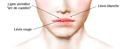 Operating diagram for lip surgery.